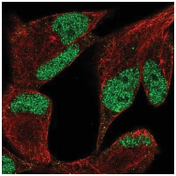 Lysine (K)-specific Demethylase 3A/KDM3A/JMJD1A Antibody, Novus Biologicals