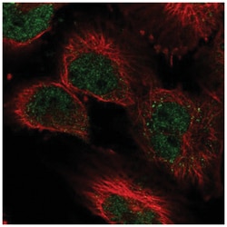 Lysine (K)-specific Demethylase 3A/KDM3A/JMJD1A Antibody, Novus Biologicals:Antibodies:Primary