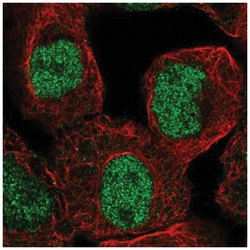 Lysine (K)-specific Demethylase 4C/KDM4C/JMJD2C Antibody, Novus Biologicals