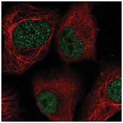 Lysyl Oxidase Homolog 2/LOXL2 Antibody, Novus Biologicals 100&mu;L; Unlabeled:Antibodies,