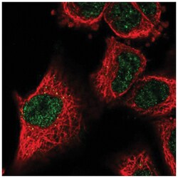 Lysyl Oxidase Homolog 2/LOXL2 Antibody, Novus Biologicals 25 &mu;L, Unlabeled:Antibodies,