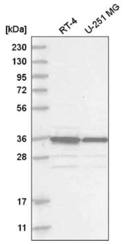 MAD2L1-binding protein Antibody, Novus Biologicals 25 &mu;L:Antibodies,