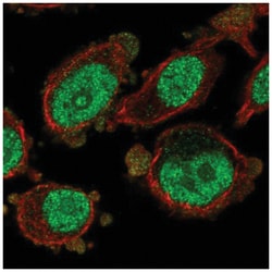 MAD3 Antibody, Novus Biologicals 100&mu;L; Unlabeled:Antibodies, Polyclonal