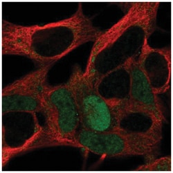MAGEA10 Antibody, Novus Biologicals:Antibodies:Primary Antibodies