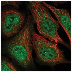MAGEA11 Antibody, Novus Biologicals:Antibodies:Primary Antibodies