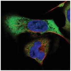 MAGEB2 Antibody, Novus Biologicals:Antibodies:Primary Antibodies