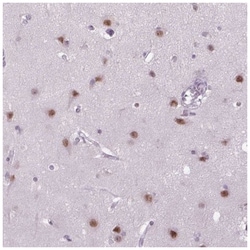 MAGEB3 Antibody, Novus Biologicals 25 &mu;L; Unlabeled:Antibodies, Polyclonal