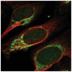 MANBAL Antibody, Novus Biologicals 25 &mu;L, Unlabeled:Antibodies, Polyclonal