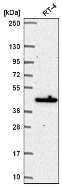 MAPKAP Kinase 3 Antibody, Novus Biologicals:Antibodies:Primary Antibodies