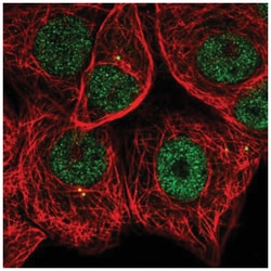 MAPKAPK2 Antibody, Novus Biologicals:Antibodies:Primary Antibodies