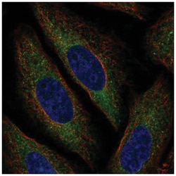 MARCH6 Antibody, Novus Biologicals 100&mu;L; Unlabeled:Antibodies, Polyclonal