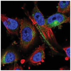 MARCKS Antibody, Novus Biologicals 100&mu;L; Unlabeled:Antibodies, Polyclonal