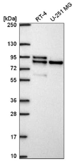 MARK2 Antibody, Novus Biologicals 100&mu;L; Unlabeled:Antibodies, Polyclonal