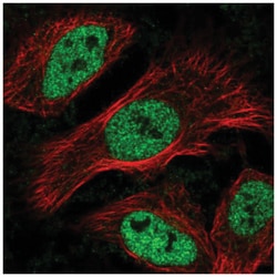 MAX binding protein Antibody, Novus Biologicals:Antibodies:Primary Antibodies