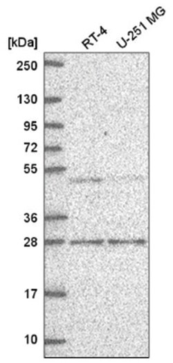 MBD2 Antibody, Novus Biologicals 100&mu;L; Unlabeled:Antibodies, Polyclonal