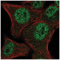 MBNL2 Antibody, Novus Biologicals 100&mu;L; Unlabeled:Antibodies, Polyclonal