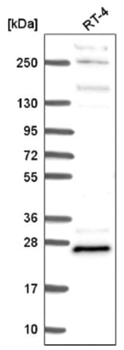 MBP Antibody, Novus Biologicals:Anticuerpos:Anticuerpos primarios