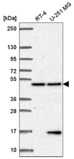 MCG10 Antibody, Novus Biologicals 100&mu;L; Unlabeled:Antibodies, Polyclonal