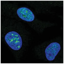 MCM10 Antibody, Novus Biologicals 100&mu;L; Unlabeled:Antibodies, Polyclonal