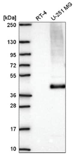 MCT1/SLC16A1 Antibody, Novus Biologicals:Antibodies:Primary Antibodies