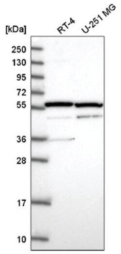 MDMX Antibody, Novus Biologicals:Antibodies:Primary Antibodies