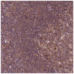 MDP1 Antibody, Novus Biologicals 25 &mu;L, Unlabeled:Antibodies, Polyclonal