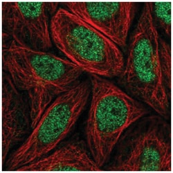MED14 Antibody, Novus Biologicals 25 &mu;L, Unlabeled:Antibodies, Polyclonal