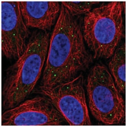 MED17 Antibody, Novus Biologicals 100&mu;L; Unlabeled:Antibodies, Polyclonal