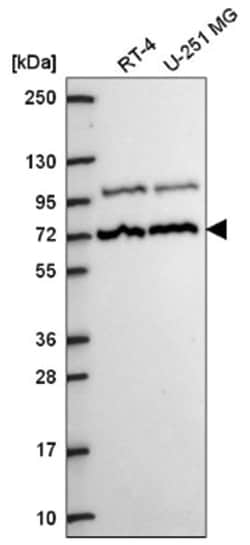 MED25 Antibody, Novus Biologicals 25 &mu;L; Unconjugated:Antibodies, Polyclonal