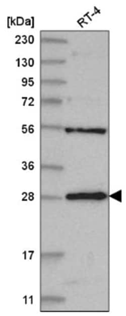 MED6 Antibody, Novus Biologicals:Antibodies:Primary Antibodies