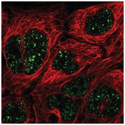 MED7 Antibody, Novus Biologicals 100&mu;L; Unlabeled:Antibodies, Polyclonal