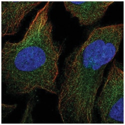 MEKK1 Antibody, Novus Biologicals 25 &mu;L, Unlabeled:Antibodies, Polyclonal