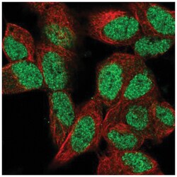 MEL-18 Antibody, Novus Biologicals 25 &mu;L, Unlabeled:Antibodies, Polyclonal
