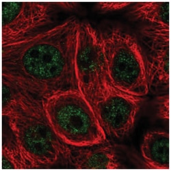 Methionine Sulfoxide Reductase B Antibody, Novus Biologicals:Antibodies:Primary