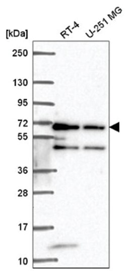 METT10D Antibody, Novus Biologicals:Antibodies:Primary Antibodies