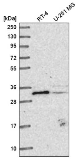 METTL1 Antibody, Novus Biologicals:Antibodies:Primary Antibodies