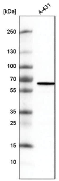 METTL14 Antibody (CL4252), Novus Biologicals 100&mu;L; Unlabeled:Antibodies,