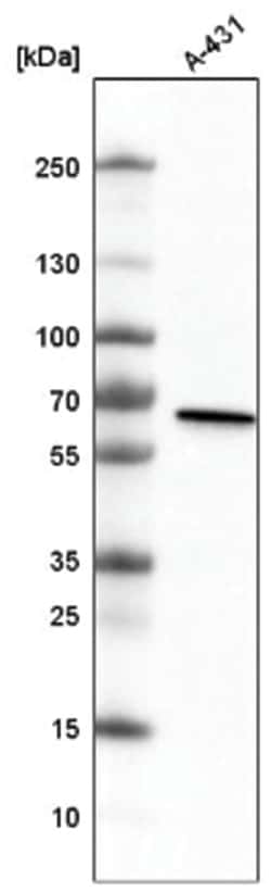 METTL14 Antibody (CL4254), Novus Biologicals:Antibodies:Primary Antibodies