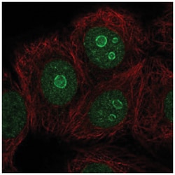 METTL22 Antibody, Novus Biologicals:Antibodies:Primary Antibodies