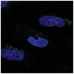MGAT2 Antibody, Novus Biologicals 100&mu;L; Unlabeled:Antibodies, Polyclonal