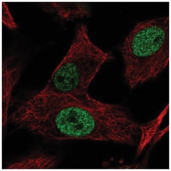 MGAT5B Antibody, Novus Biologicals 25 &mu;L | Buy Online | Novus Biologicals | Fisher Scientific