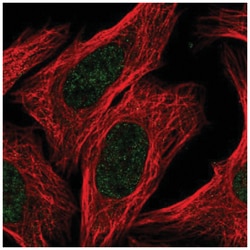 MgcRacGAP/RACGAP1 Antibody, Novus Biologicals 25 &mu;L:Antibodies, Polyclonal