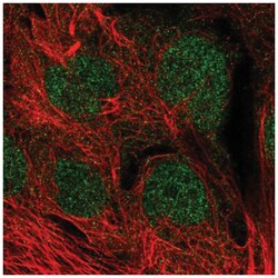 MGMT Antibody, Novus Biologicals 100&mu;L; Unlabeled:Antibodies, Polyclonal