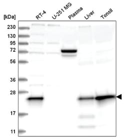 MGMT Antibody, Novus Biologicals:Antibodies:Primary Antibodies