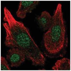 MGST3 Antibody, Novus Biologicals 100 &mu;L | Buy Online | Novus Biologicals | Fisher Scientific
