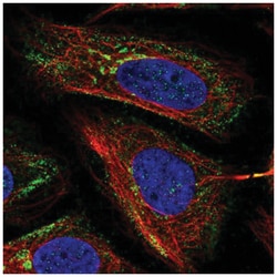 MICB Antibody, Novus Biologicals 25 &mu;L, Unlabeled:Antibodies, Polyclonal
