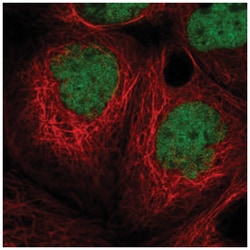 MIER1 Antibody, Novus Biologicals 100&mu;L; Unlabeled:Antibodies, Polyclonal