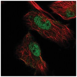 MIER3 Antibody, Novus Biologicals 25 &mu;L, Unlabeled:Antibodies, Polyclonal