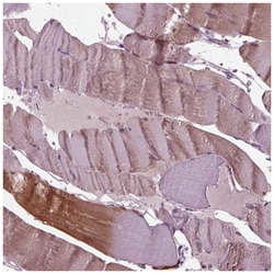 Mind Bomb 2/MIB2 Antibody, Novus Biologicals 100 &mu;L | Buy Online | Novus Biologicals | Fisher Scientific