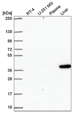 Mindin/Spondin-2 Antibody, Novus Biologicals 100&mu;L; Unlabeled:Antibodies,